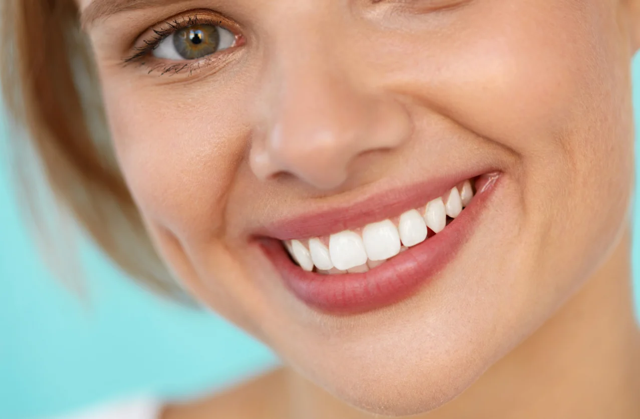Composite Bonding Pimlico Victoria London Cosmetic Dentistry Consultations Announced at McKennell Dental Practice